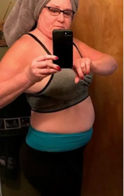 Dawn K. before the NutriWave program