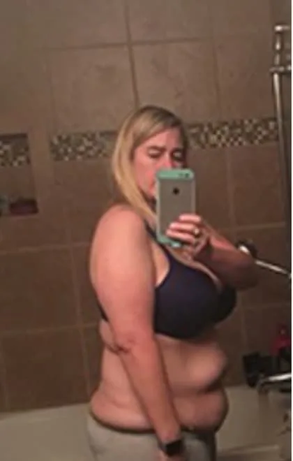 Kristen D. before the NutriWave program