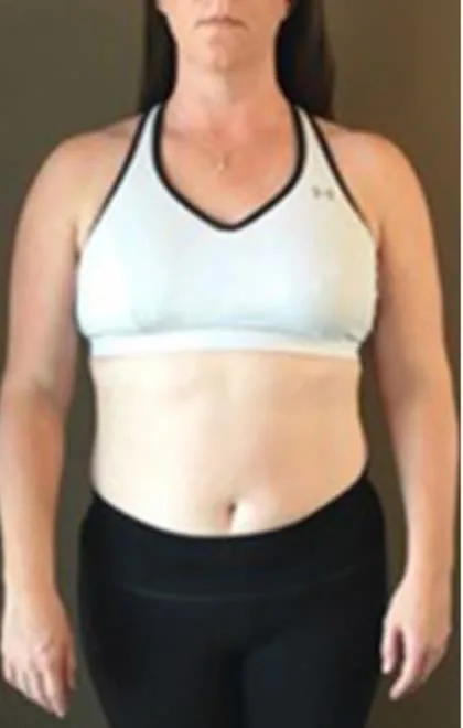 Traci C. before the NutriWave program
